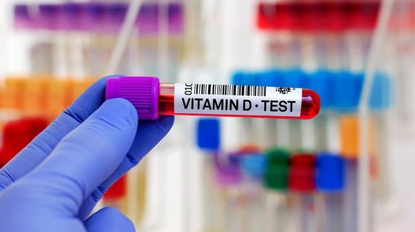 Când aveți nevoie de un test de vitamina D?